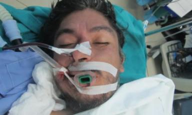 Atropellan a un hombre y dejan abandonado en la Panamericana Norte